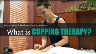 What is Cupping? How Does Cupping Therapy Work? - Back to Health Wellness Centre