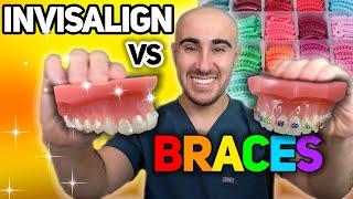 Braces vs Invisalign: Cost, Tooth Pain, Speed, etc - The ULTIMATE Review 