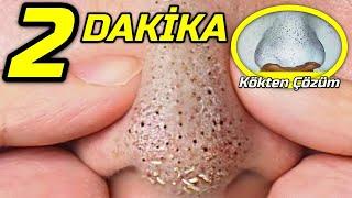 2 DAKİKADA CİLDİ YÜZÜ PORSELEN GİBİ YAPAN Gözenek Kapatıcı MASKE! │ Güzellik Bakım