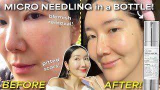 MOST VIRAL "IT GIRL" VT Reedle Shot | Get non-surgical aesthetic-level results at home!
