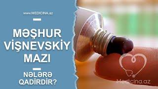 Bir zamanların məşhur Vişnevskiy mazı - Nələrə qadirdir?