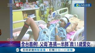 各捐一半肺！11歲小妹妹靠葉克膜維生長達4個月 父母決定各出一半肺葉來救女兒 歷經15個小時手術 全台首例"活體肺葉移植"順利成功｜記者 侯彩紅 林楷鈞｜【暖心亮起來】20230115｜三立新聞台