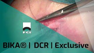 BIKA® | Bicanalicular Intubation System | External DCR | Procedure | Exclusive | FCI Lacrimal