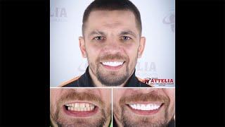 Ivan Redkach (Professional boxer) | Attelia Dental Turkey