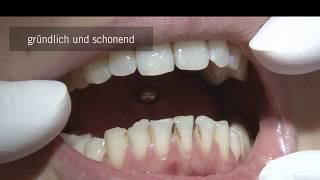 CleanJoy – Fluoridhaltige Zahnreinigungs- und Polierpaste | VOCO GmbH - Deutsch