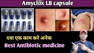 Amyclox LB capsule use dose benefits and side effects full review in hindi