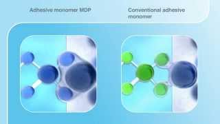 Kuraray Self Etching Technology with MDP Monomer