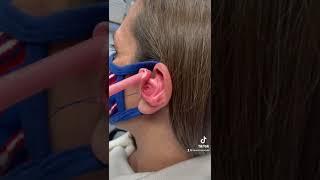 #billsmafia for the win  #earimpression #satisfying #earwax #audiologist #audiology #earwaxremoval