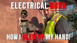 Electrical Panel Upgrade HIGH VOLTAGE ARC FLASH BLAST | How I BLEW UP MY HAND