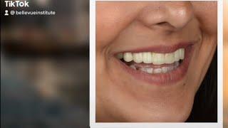 Avoir de belles dents peut être une source de bonheur 