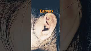 Earwax remove alot of #shorts