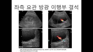 2022-11-9 영남 임상 초음파 연구회 강의, 방광 초음파(2) 김일봉