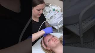 Diamond Tip Microdermabrasion Treatment  Tanner Clinic #shorts