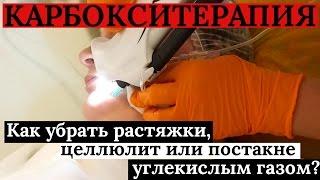 Карбокситерапия убирает ПОСТАКНЕ, РАСТЯЖКИ и ЦЕЛЛЮЛИТ! Стимулирует рост волос!