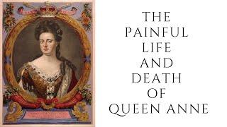 The PAINFUL Life And Death Of Queen Anne