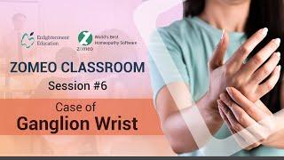 Zomeo Homeopathy Software: Case of Ganglion Wrist