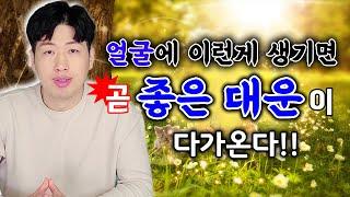 얼굴에 이런게 생기면 대박운이 다가올 징조입니다 !! 대박나는 관상