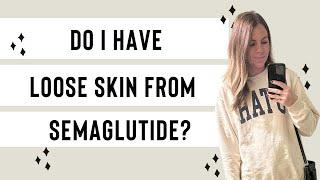 Do I have loose skin from Semaglutide??