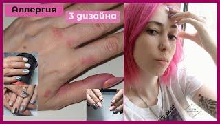 АЛЛЕРГИЯ на руках/Расходники с инсты/3 дизайна