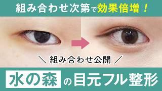 【医師解説】目を大きくする美容整形って何がある？二重整形に組み合わせるお勧めの治療法をご紹介【二重埋没法】【二重切開法】【目頭切開】【たれ目形成】水の森美容クリニック