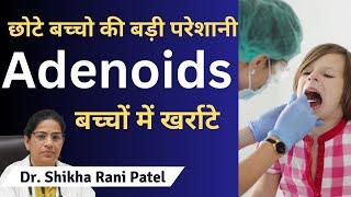 Adenoids kya hota hai । Enlarged adenoids । बच्चों में खराटे | Adenoid Surgery, Snoring, Block nose