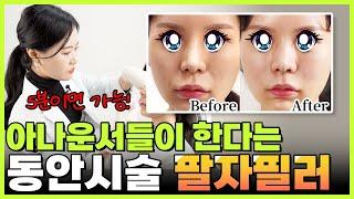 아나운서들이 한다는 10년어려지는 동안시술 팔자필러 생생후기! 부천팔자필러, 부천피부과
