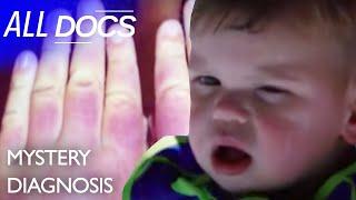 The Boy Who Kept Swelling | S06 E06 | Medical Documentary | All Documentary