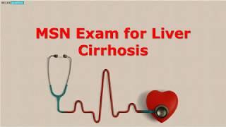 Nclex Questions On Liver Cirrhosis