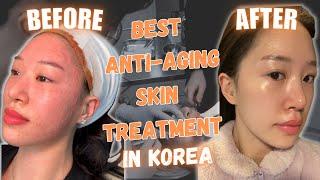 Trying Korean Anti-Aging Treatment in Korea | Renovo Skin Clinic