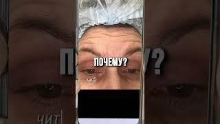 НИКОГДА НЕ ДЕЛАЙТЕ БОТОКС! Это я как врач косметолог вам говорю!  #ботокс #botox