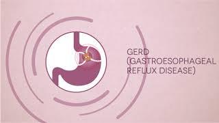 Gastrointestinal Problems & Symptoms | Digestive System Diseases | Fortis Bangalore