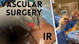 Vascular Surgery or Interventonal Radiology