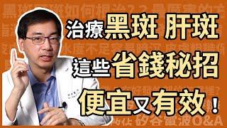 治療黑斑、肝斑，有哪些省錢又有效，高CP值的方法？醫美里長林政賢醫師大揭密！