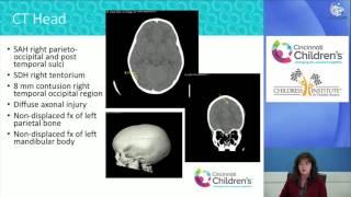 GlobalCast Web Symposium 2016 #4 Arrival to trauma center