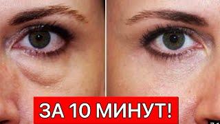 МЕШКИ и ОТЕКИ под глазами. Как убрать отеки под глазами? Рецепт. Малярные мешки и отеки/рецепт