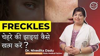 Freckles kyu hota hai? | फ्रेकल्स और दाग धब्बे का ईलाज | Best Skin Specialist in Delhi | Dr.Nivedita