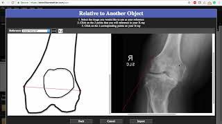 Bonesetter App How to size and enter x-rays