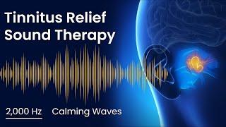 Tinnitus Sound Therapy - 2,000 Hz Calming Waves | 2 Hours | Sound Masking for Ringing in Ears