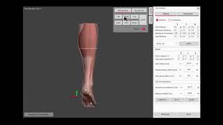 CLOUD CAD/CAM Solution for Orthopedic
