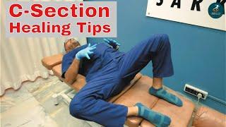 Exercises after C-Section | Dr Sanjay Sarkar | Best Chiropractor in India