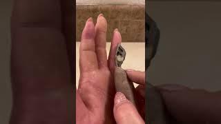 Rasp Experiments on Hands with EPPK Keratoderma Callus  - Jun 27, 2023