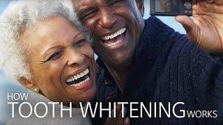 How Tooth Whitening Works