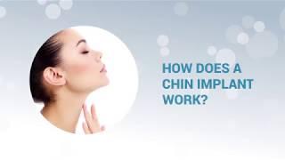 How Does a Chin Implant Work?