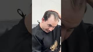 Amazing Hair Transplant Experience in Delhi 2024 | MedLinks #shorts #shortsfeed .