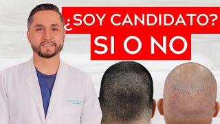 ¿Cómo sé si soy CANDIDATO para un INJERTO CAPILAR?