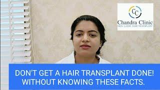 Is Hair Transplant Permanent? | Best Hair Transplant Clinic in Delhi | Chandra Hair Clinic
