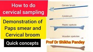 Cervical sampling methods demonstration, Pap's smear, cervical brush @saisamarthgyneclasses