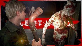 Krrrrrrrrankenstttttttation  SILENT HILL 2 Remake #36