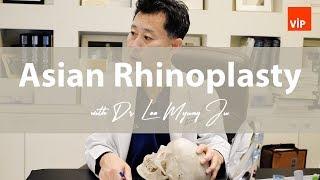 Asian Rhinoplasty | VIP Plastic Surgery Korea