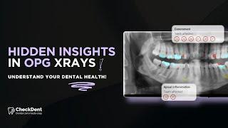 Dental OPG X-Rays Explained: What You Need to Know